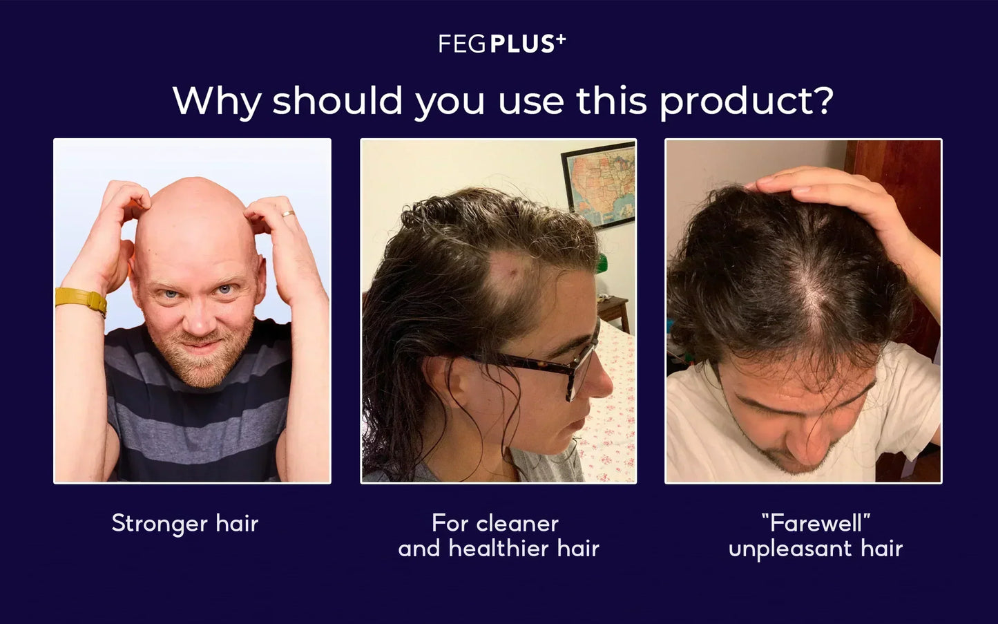 FEG Plus Organic Hair Growth Treatment Oil